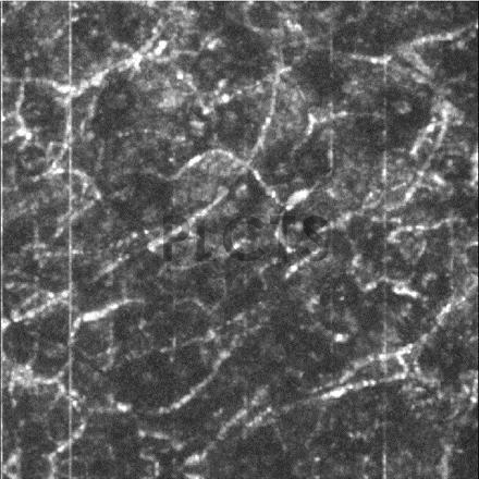 小鼠耳部的血管造影圖像2